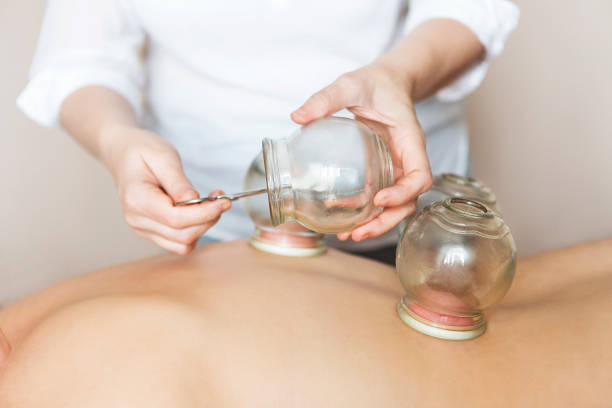 Cupping stock image